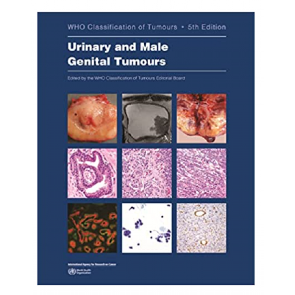 WHO's Classification Of Tumours: Urinary And Male Genital Tumours; 5th ...